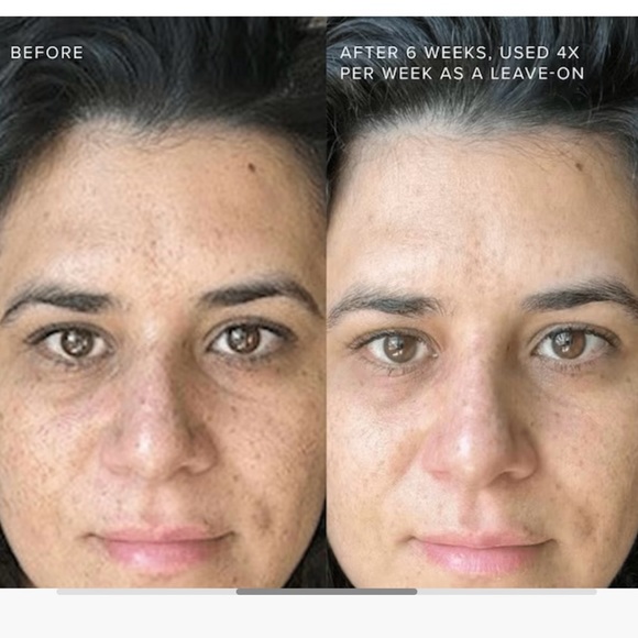 Rodan+Fields Multi-Acid Enzyme Peel - Picture 5 of 5